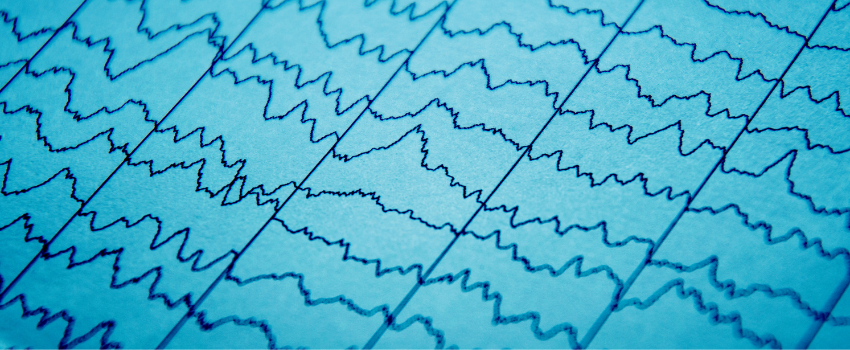 Mapping ALS; gebruik van EEG's in onderzoek naar ALS